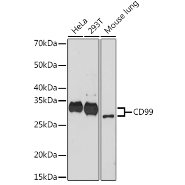 Western Blot - Anti-CD99 Antibody [ARC1752] (A309328) - Antibodies.com