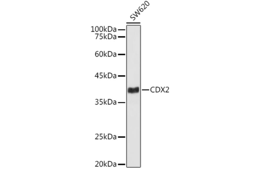 Western Blot - Anti-CDX2 Antibody [ARC3070] (A309330) - Antibodies.com