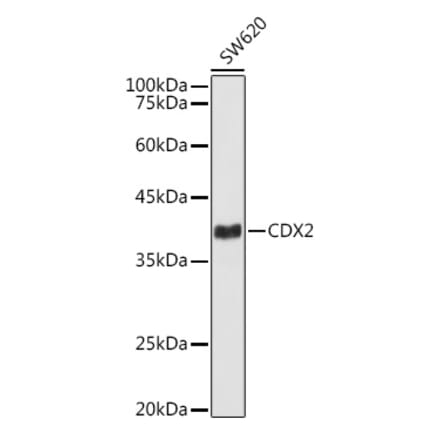 Western Blot - Anti-CDX2 Antibody [ARC3070] (A309330) - Antibodies.com