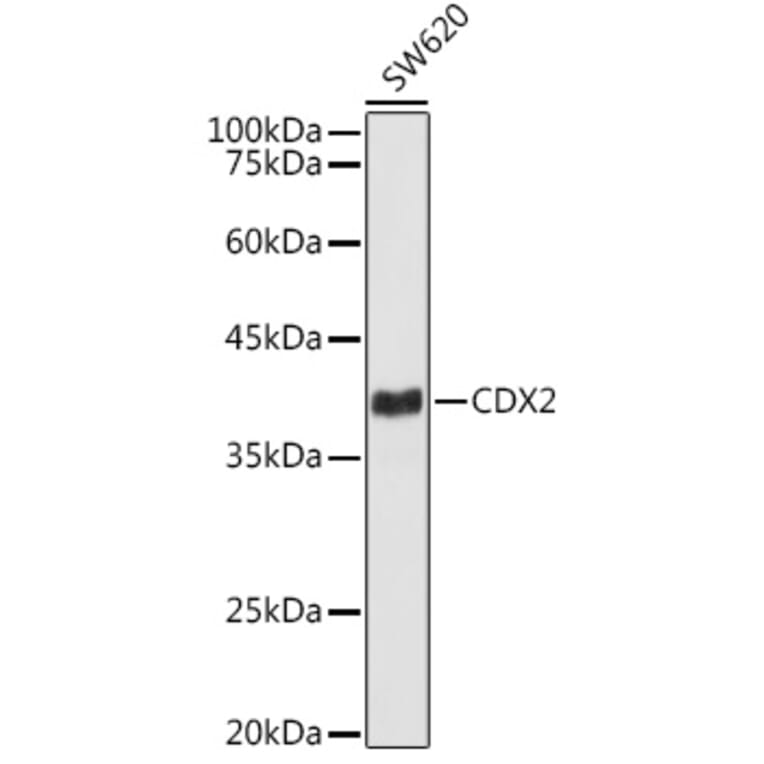 Western Blot - Anti-CDX2 Antibody [ARC3070] (A309330) - Antibodies.com