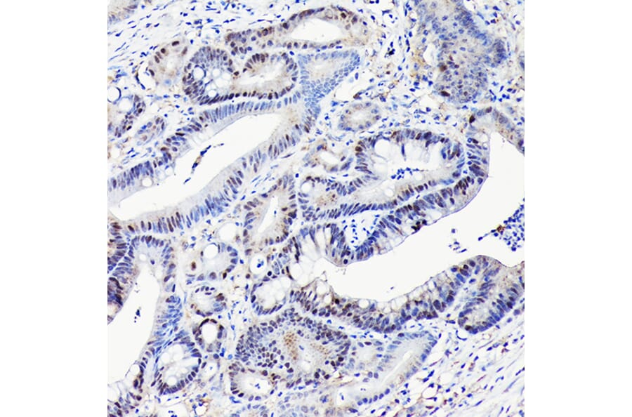 Immunohistochemistry - Anti-CDX2 Antibody [ARC3070] (A309330) - Antibodies.com