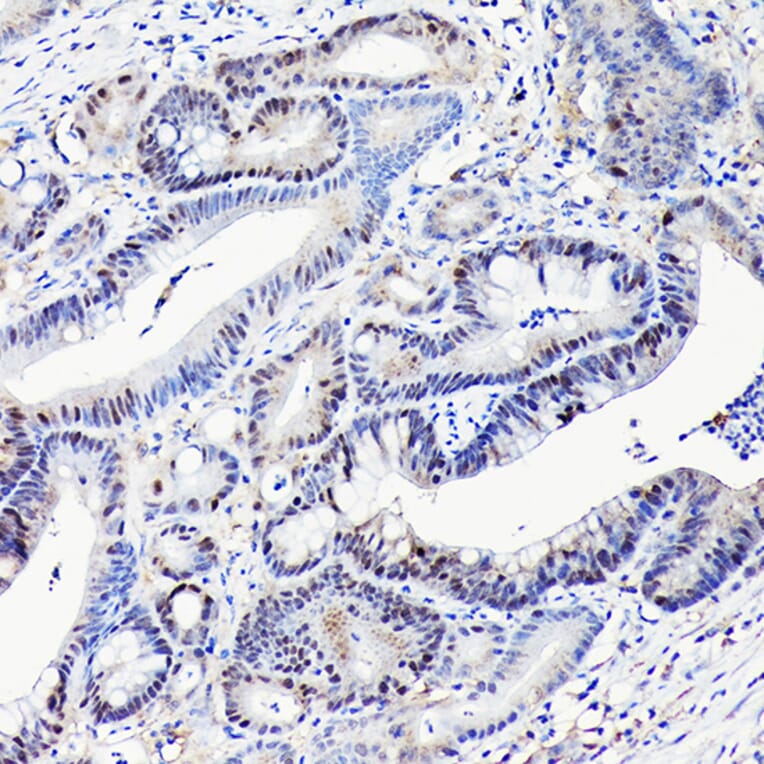 Immunohistochemistry - Anti-CDX2 Antibody [ARC3070] (A309330) - Antibodies.com