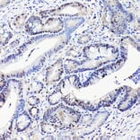Immunohistochemistry - Anti-CDX2 Antibody [ARC3070] (A309330) - Antibodies.com