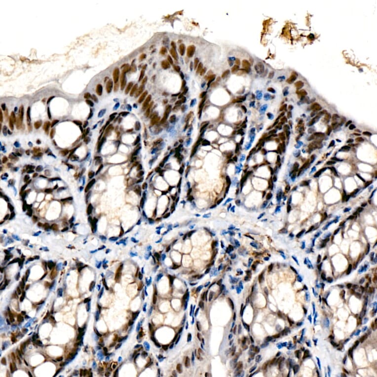 Immunohistochemistry - Anti-Chd1 Antibody [ARC59018] (A309331) - Antibodies.com
