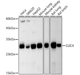 Western Blot - Anti-CLIC4 Antibody [ARC2998] (A309335) - Antibodies.com