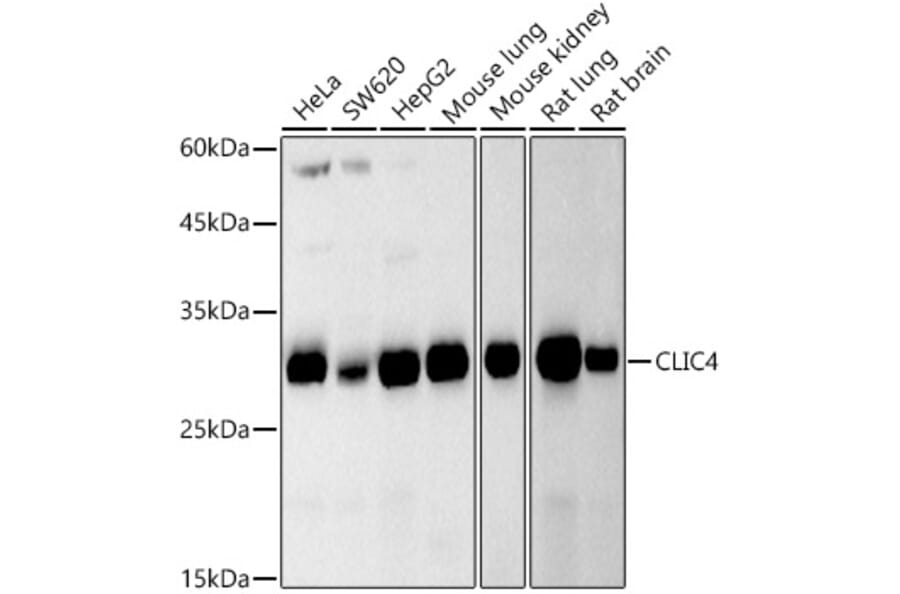 Western Blot - Anti-CLIC4 Antibody [ARC2998] (A309335) - Antibodies.com