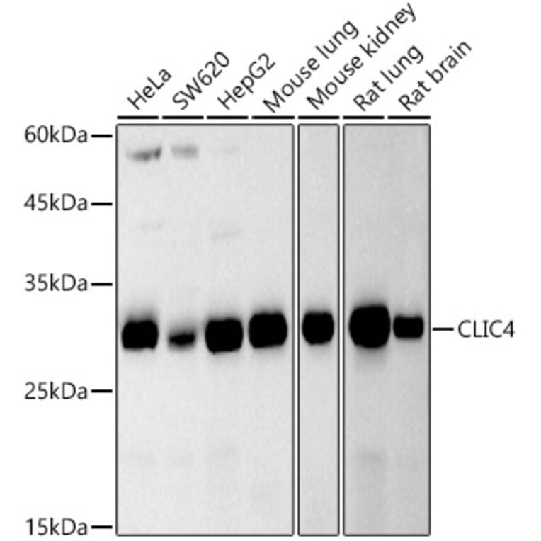 Western Blot - Anti-CLIC4 Antibody [ARC2998] (A309335) - Antibodies.com