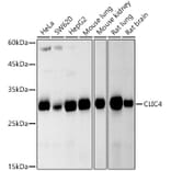 Western Blot - Anti-CLIC4 Antibody [ARC2998] (A309335) - Antibodies.com