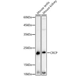 Western Blot - Anti-CRCP Antibody [ARC3031] (A309337) - Antibodies.com