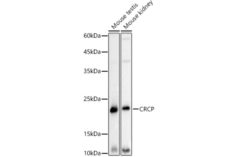 Western Blot - Anti-CRCP Antibody [ARC3031] (A309337) - Antibodies.com