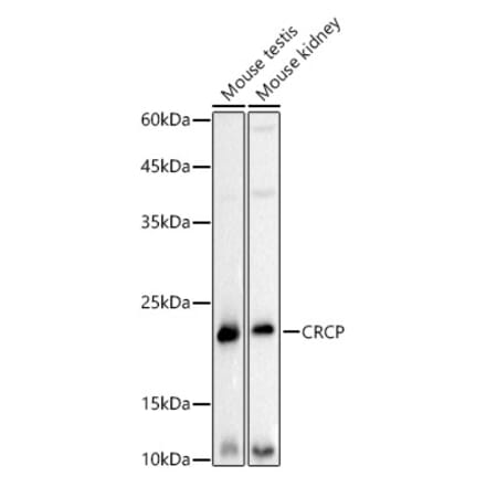 Western Blot - Anti-CRCP Antibody [ARC3031] (A309337) - Antibodies.com