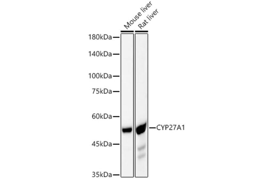 Western Blot - Anti-CYP27A1 Antibody [ARC59606] (A309338) - Antibodies.com