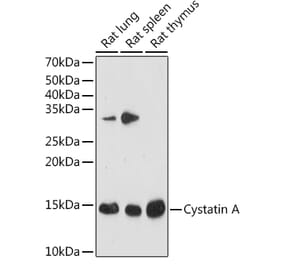 Western Blot - Anti-Cystatin A Antibody [ARC1993] (A309340) - Antibodies.com