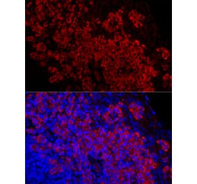 Immunofluorescence - Anti-DARC Antibody [ARC59631] (A309341) - Antibodies.com