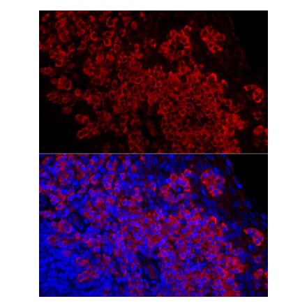 Immunofluorescence - Anti-DARC Antibody [ARC59631] (A309341) - Antibodies.com