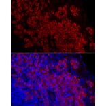 Immunofluorescence - Anti-DARC Antibody [ARC59631] (A309341) - Antibodies.com