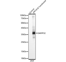 Western Blot - Anti-DARPP32 Antibody [ARC59935] (A309342) - Antibodies.com