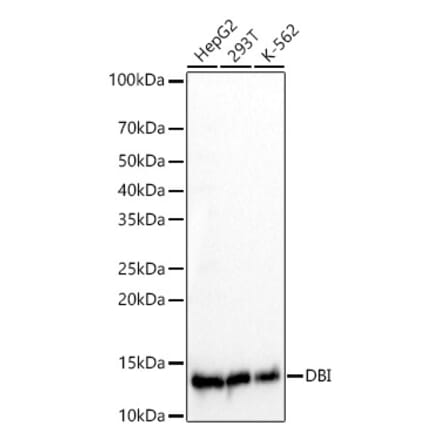 Western Blot - Anti-DBI Antibody [ARC60030] (A309344) - Antibodies.com