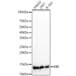 Western Blot - Anti-DBI Antibody [ARC60030] (A309344) - Antibodies.com