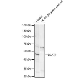 Western Blot - Anti-DGAT1 Antibody [ARC58697] (A309345) - Antibodies.com