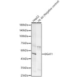 Western Blot - Anti-DGAT1 Antibody [ARC58697] (A309345) - Antibodies.com