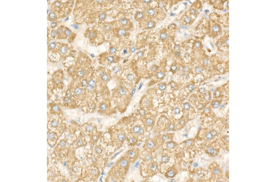 Immunohistochemistry - Anti-DGAT1 Antibody [ARC58696] (A309346) - Antibodies.com