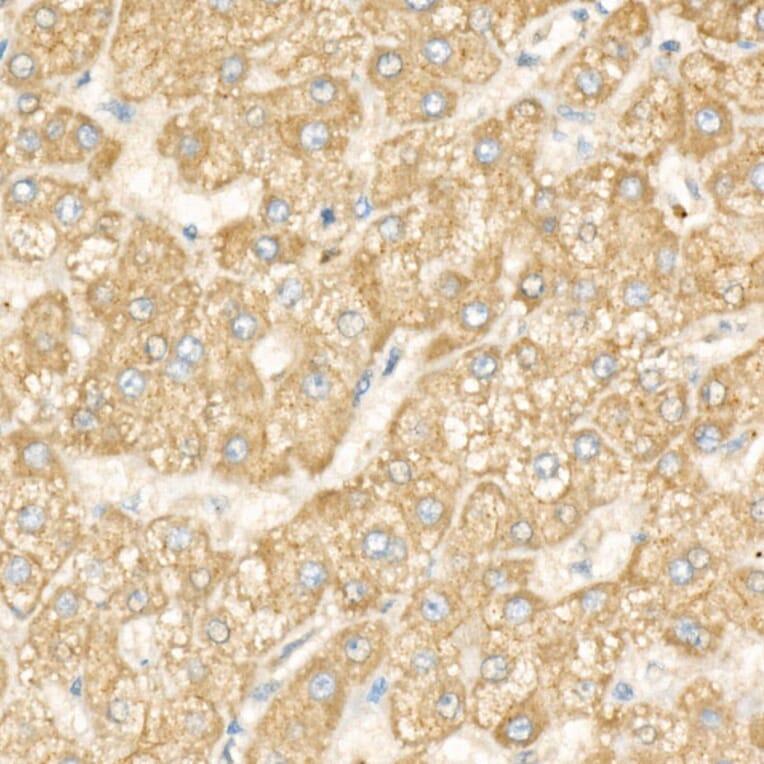 Immunohistochemistry - Anti-DGAT1 Antibody [ARC58696] (A309346) - Antibodies.com