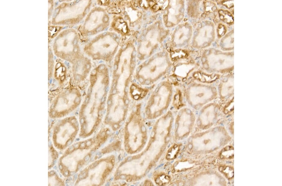Immunohistochemistry - Anti-DGAT1 Antibody [ARC58696] (A309346) - Antibodies.com