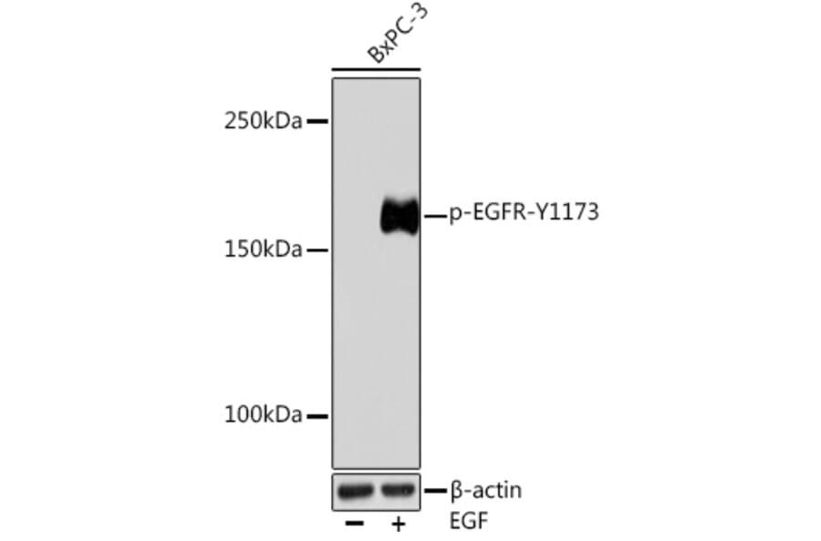 Western Blot - Anti-EGFR (phospho Tyr1173) Antibody (A309350) - Antibodies.com