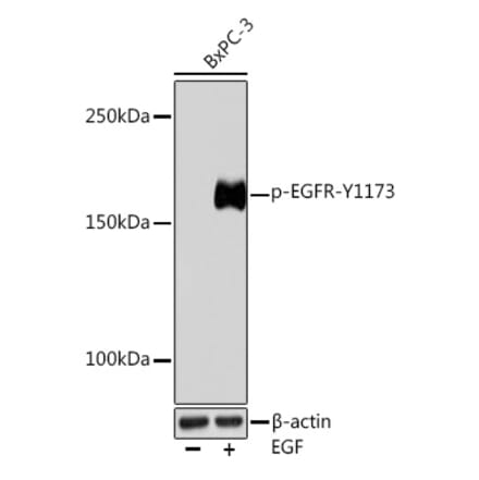 Western Blot - Anti-EGFR (phospho Tyr1173) Antibody (A309350) - Antibodies.com