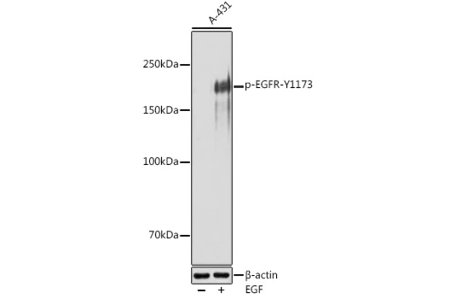 Western Blot - Anti-EGFR (phospho Tyr1173) Antibody (A309351) - Antibodies.com