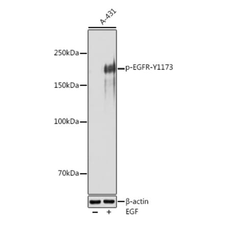 Western Blot - Anti-EGFR (phospho Tyr1173) Antibody (A309351) - Antibodies.com
