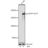 Western Blot - Anti-EGFR (phospho Tyr1173) Antibody (A309351) - Antibodies.com