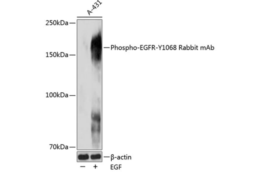 Western Blot - Anti-EGFR (phospho Tyr1068) Antibody (A309353) - Antibodies.com