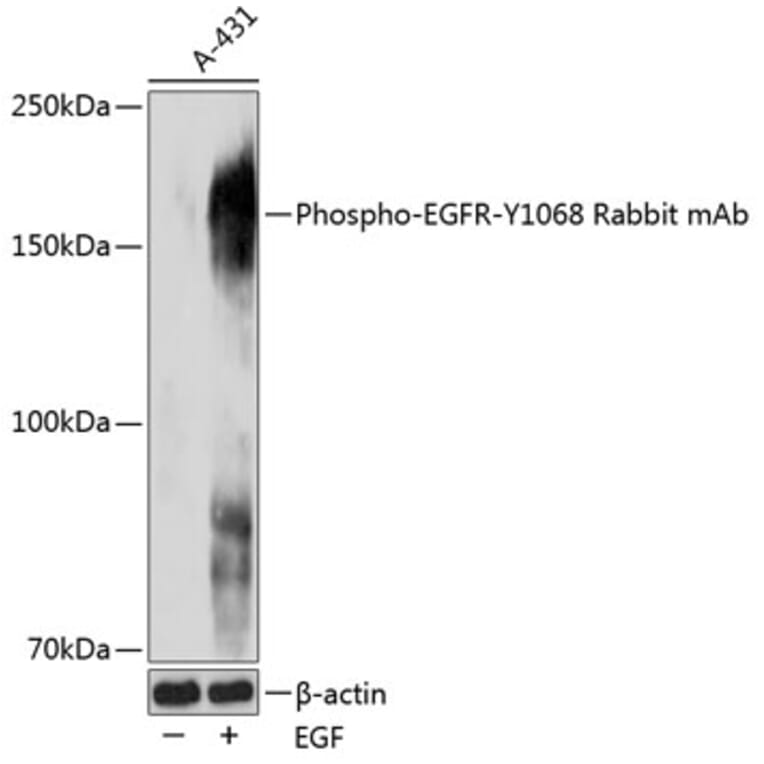 Western Blot - Anti-EGFR (phospho Tyr1068) Antibody (A309353) - Antibodies.com