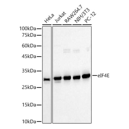 Western Blot - Anti-eIF4E Antibody (A309356) - Antibodies.com
