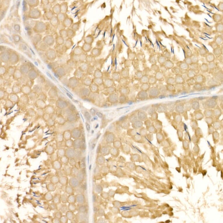 Immunohistochemistry - Anti-eIF4E Antibody (A309356) - Antibodies.com