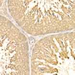 Immunohistochemistry - Anti-eIF4E Antibody (A309356) - Antibodies.com