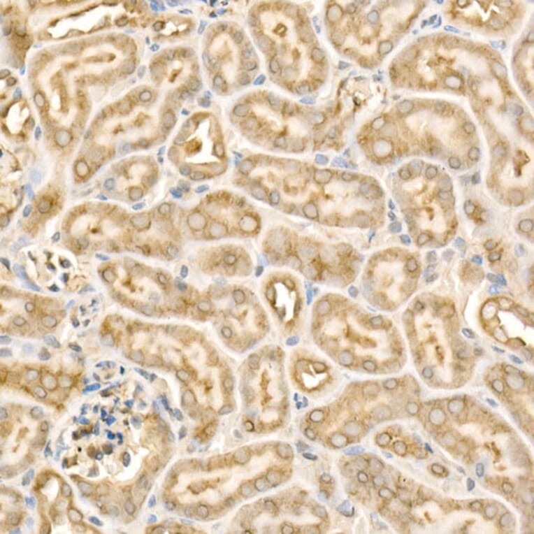 Immunohistochemistry - Anti-eIF4E Antibody (A309356) - Antibodies.com