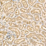 Immunohistochemistry - Anti-eIF4E Antibody (A309356) - Antibodies.com