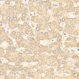 Immunohistochemistry - Anti-eIF4E Antibody (A309356) - Antibodies.com