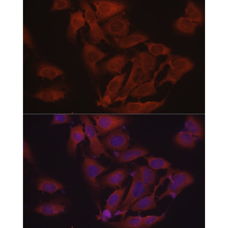 Immunofluorescence - Anti-eIF4E Antibody (A309356) - Antibodies.com