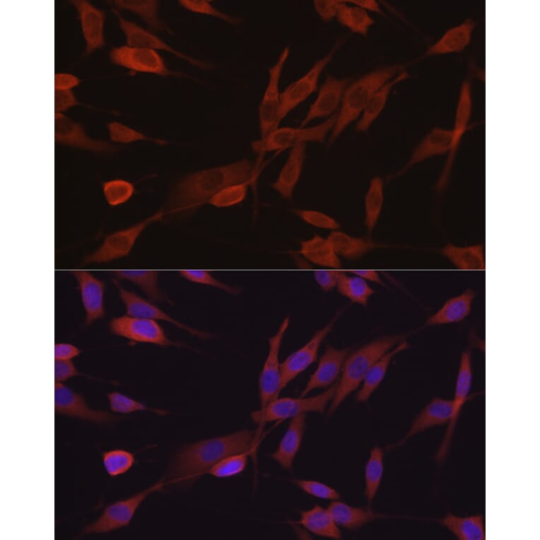 Immunofluorescence - Anti-eIF4E Antibody (A309356) - Antibodies.com