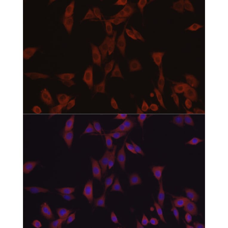 Immunofluorescence - Anti-eIF4E Antibody (A309356) - Antibodies.com