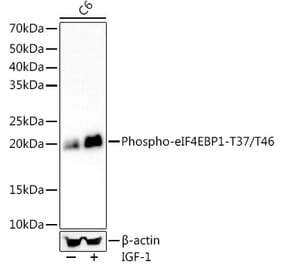 Western Blot - Anti-eIF4EBP1 (phospho Thr37 + Thr46) Antibody (A309357) - Antibodies.com