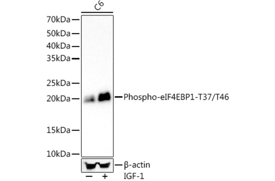 Western Blot - Anti-eIF4EBP1 (phospho Thr37 + Thr46) Antibody [ARC56491] (A309357) - Antibodies.com