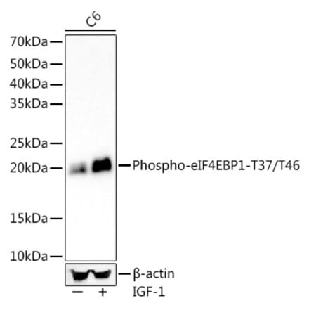 Western Blot - Anti-eIF4EBP1 (phospho Thr37 + Thr46) Antibody [ARC56491] (A309357) - Antibodies.com