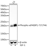 Western Blot - Anti-eIF4EBP1 (phospho Thr37 + Thr46) Antibody [ARC56491] (A309357) - Antibodies.com