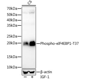 Western Blot - Anti-eIF4EBP1 (phospho Thr37) Antibody (A309358) - Antibodies.com