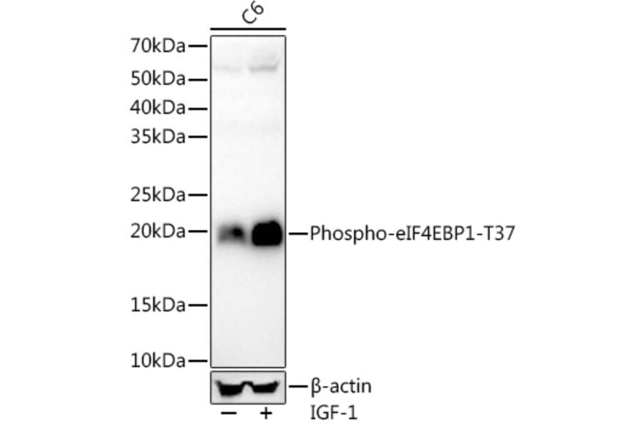 Western Blot - Anti-eIF4EBP1 (phospho Thr37) Antibody [ARC56857] (A309358) - Antibodies.com